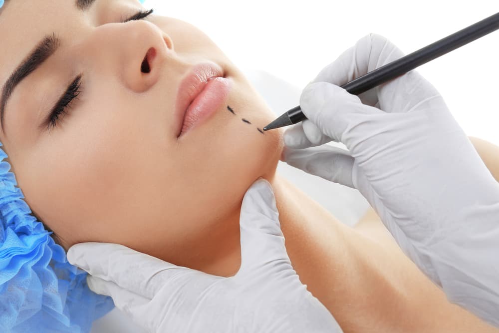 Right Surgeon for Chin Augmentation